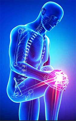 A human anatomy picture of a man holding his knee up with both hands.